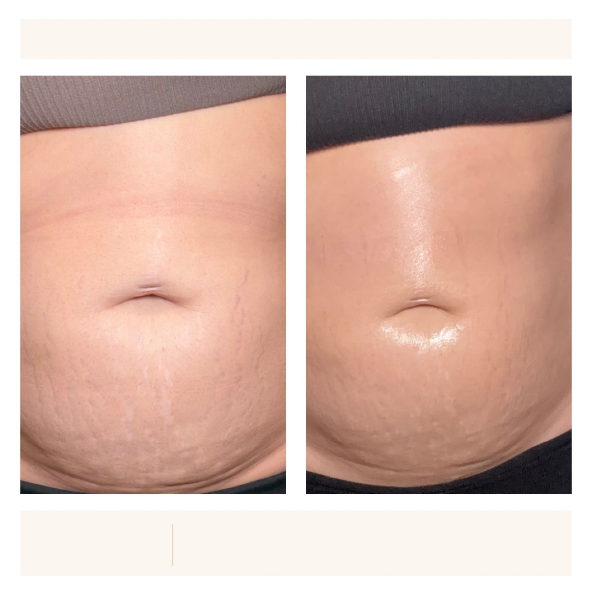 GoPure Belly Cream before and after photos dated July 15 to August 19